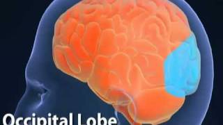 Understanding Partial Seizures Epilepsy 3  YouTubeflv [upl. by Gamal]