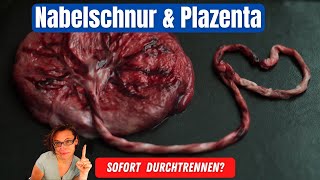 Plazenta amp Nabelschnur  nicht sofort durchtrennen [upl. by Eelarual627]