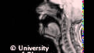 MRI voiced bilibial implosive [upl. by Eniffit]