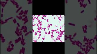 Gram negative bacilli microscopy staining microbiology gnb viral [upl. by Pancho]