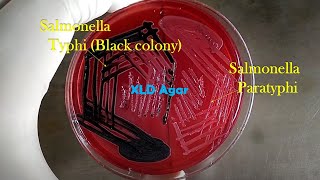 Salmonella Typhi and Salmonella Paratyphi growth on XLD agar [upl. by Eissirc]