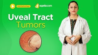 Uveal Tract Tumors  Ophthalmology Online Lecture  Medical Education  VLearning [upl. by Jacobson936]