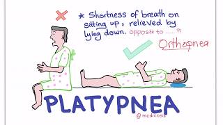 PlatypneaOrthodeoxia Syndrome [upl. by Culver]