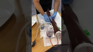 Performing venepuncture using BDEclipse [upl. by Trager]