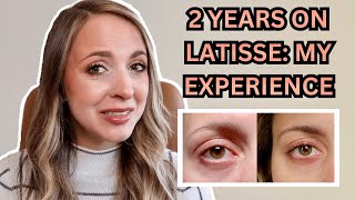 2 YEARS USING LATISSE MY RESULTS  Any Negative Side Effects Is It Worth The Money [upl. by Dalston337]