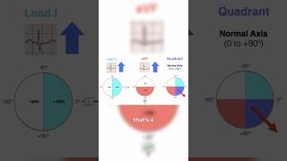 How to identify an axis deviation on an EKG ￼ [upl. by Eldnar978]