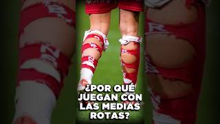 ¿Por qué JUEGAN con las MEDIAS ROTAS ⚽ [upl. by Malcah277]