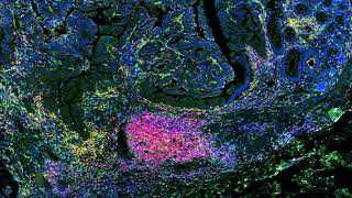 Introduction to Immunology [upl. by Nilahs]