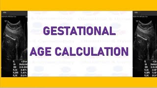 How to Measure Gestational Age with the Help of Multiple Ultrasound Parameters [upl. by Revkah714]