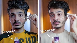 Skincare Routine For Hyperpigmentation amp Dark Spots  CeraVe [upl. by Hanni178]