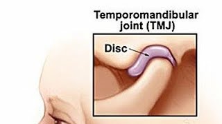 TMJ temporomandibular joint snell anatomy شرح بالعربي [upl. by Rothstein]