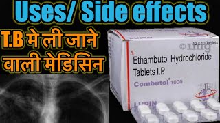 Combutol Tablet  Ethambutol Hydrochloride Tablet  TB ki Dawa  TB Medicine  Dose Side Effects [upl. by Alys]