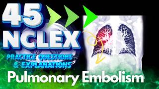 NCLEX RN 45 Pulmonary Embolism Practice Questions amp Answers  Essential Nursing Knowledge [upl. by Ardnuhsor]