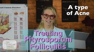 Treat Pityrosporum Folliculitis Dermatologists Tips 2019 [upl. by Rivard]