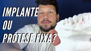 Implante ou prótese fixa  Dr Victor Hugo Almeida [upl. by Aivital]