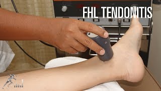 Flexor hallucis longus FHL tendinitis Signs symptoms and treatment options [upl. by Aimahs147]