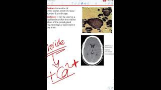 Pineal gland Histology [upl. by Electra]