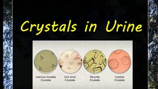 Urine Examination3 Crystals [upl. by Ydolem309]