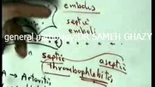 general pathology 7 toxaemia septicaemiapyaemiabacteraemia  repair1 by DR SAMEH GHAZY [upl. by Madelina]