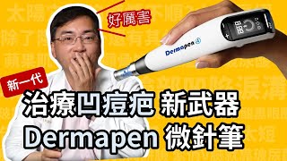 治凹痘疤，新武器 Dermapen 得美微針筆，第四代微針筆，治療凹痘疤快速又方便！ [upl. by Brynna]