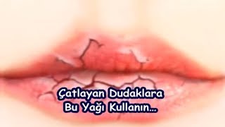 Çatlayan Dudaklara Bu Yağı Kullanın… [upl. by Tansey]