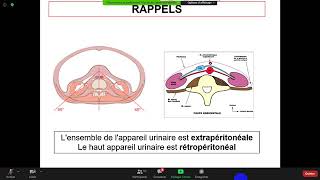 Pr Rahmouni  Néphrologie Insuffisance rénale aigue [upl. by Swan]