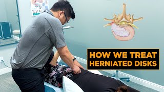 How We Treat a Herniated Disk  Physical Therapy [upl. by Susejedesoj]