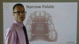 A Narrow Palate By Dr Mike Mew [upl. by Onek]