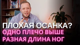 ПЛОХАЯ ОСАНКА разная длина ног перекос таза плечи на разном уровне – зачем вас этим пугают [upl. by Eiclud]