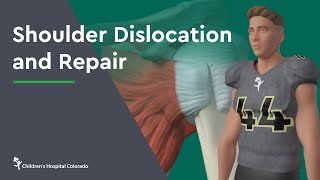 Shoulder Dislocation and Repair [upl. by Eitak]