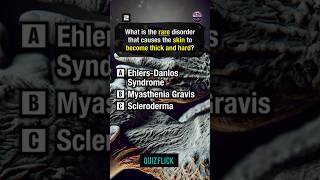 Hard level genetic Disorders Quizshorts [upl. by Biebel]