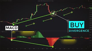 Trading MACD Divergences Like Professional Traders Forex amp Stocks Strategy [upl. by Avenej]