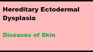 Hereditary Ectodermal Dysplasia  Diseases of Skin [upl. by Selestina]