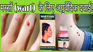 Wart remover lotion  मस्सों के लिए अयुर्वेदिक दवाई  Wartosin wart remover Ayurvedic lotion [upl. by Selec840]