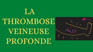 La thrombose veineuse profonde simplifiée [upl. by Krell]