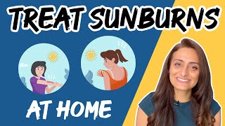 Sunburn का घर पर ऐसे करें treatment  Sunburn Causes amp Treatment  Dr Aanchal [upl. by Yuu178]