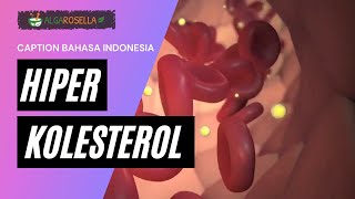 Video Animasi – Hiperlipidemia  Kolesterol Tinggi sub Indonesia [upl. by Roane]