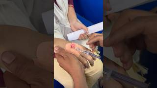 How to give iv injection with venflon doctor shotsviralshorts trendingshorts [upl. by Nnylcaj]