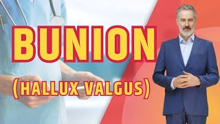 What is BUNION Hallux Valgus The Truth About Bunions [upl. by Hamburger]