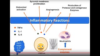 Rheumatoid Arthritis pathology in 5 minutes [upl. by Jerrilyn]