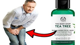 How To Get Rid of Jock Itch With Tea Tree Oil  EFFECTIVE NATURAL TREATMENT [upl. by Annazor704]