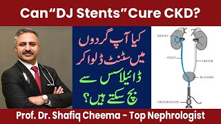 Can DJ Stents cure CKD or Kidney Disease  Top Nephrologist [upl. by Ellwood]