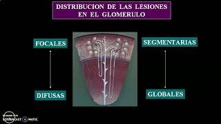 Teórico N°75 Glomerulopatias I [upl. by China]