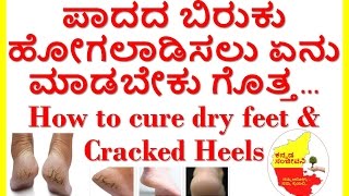 How to cure dry feet amp cracked heels at homeKannada Sanjeevani [upl. by Suiratnod]