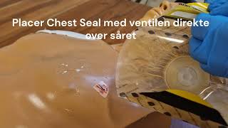 Chest Seal [upl. by Etnad]