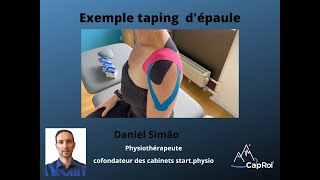 Présentation dun taping de lépaule [upl. by Leahcimnhoj353]