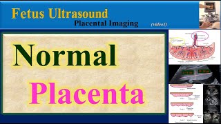 Fetus Ultrasound  Normal Placenta [upl. by Yalahs]