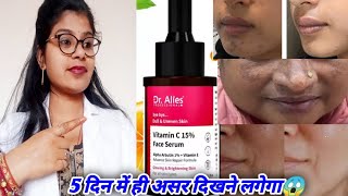 Dr alies vitamin c 15 face serum honest review  Dr alies vitamin c15 face serum best review hindi [upl. by Elbring]