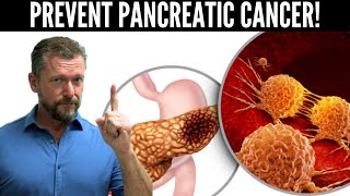 Lower Pancreatic Cancer Risk Pancreas Cancer Risk Test [upl. by Karina679]