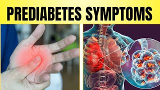 Dont Ignore These 13 Hidden Symptoms of Pre Diabetes [upl. by Areem]